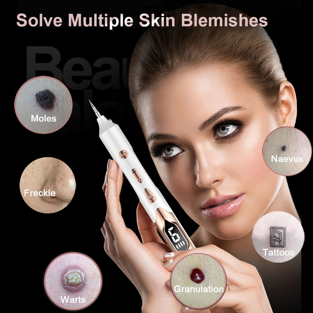 Laser Plasma Pen for Skin Tag Removal