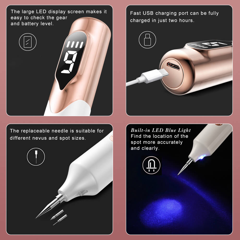 Laser Plasma Pen for Skin Tag Removal