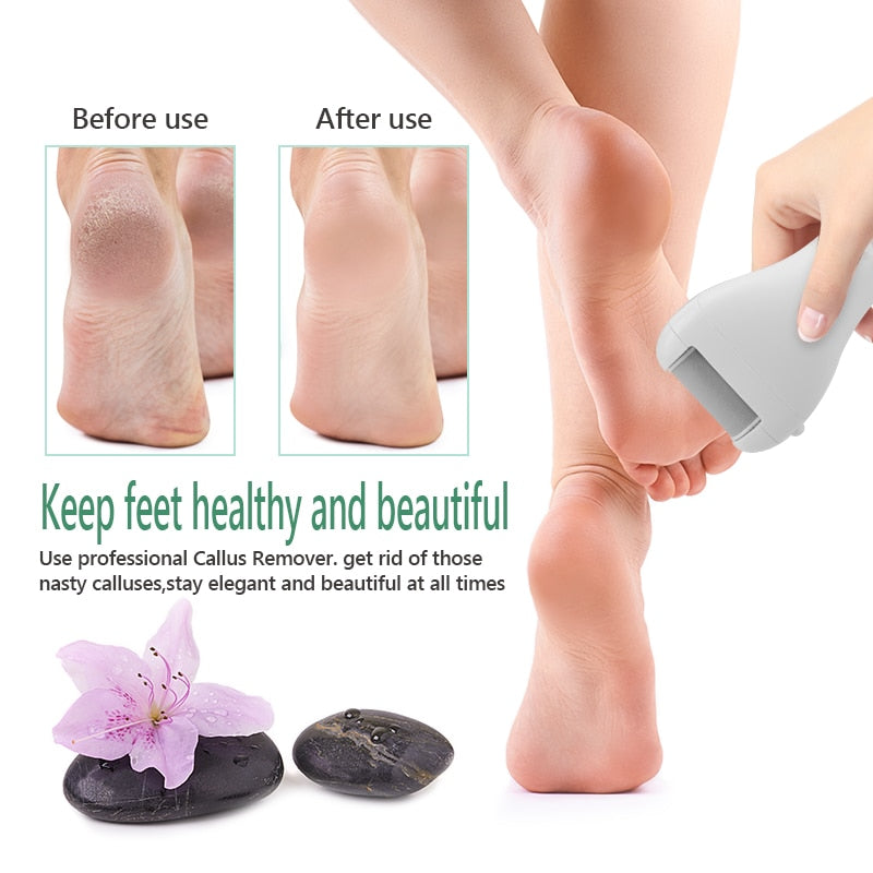 Electric Foot File for Heels Grinding