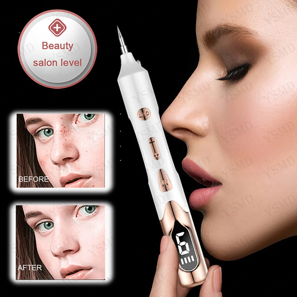 Laser Plasma Pen for Skin Tag Removal